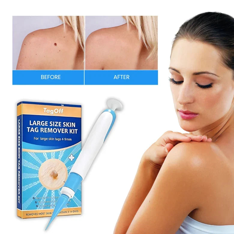 Huidverzorgingsformule 30ml met Precisie-applicator en Natuurlijk Extract voor Gerichte Huidverzorging