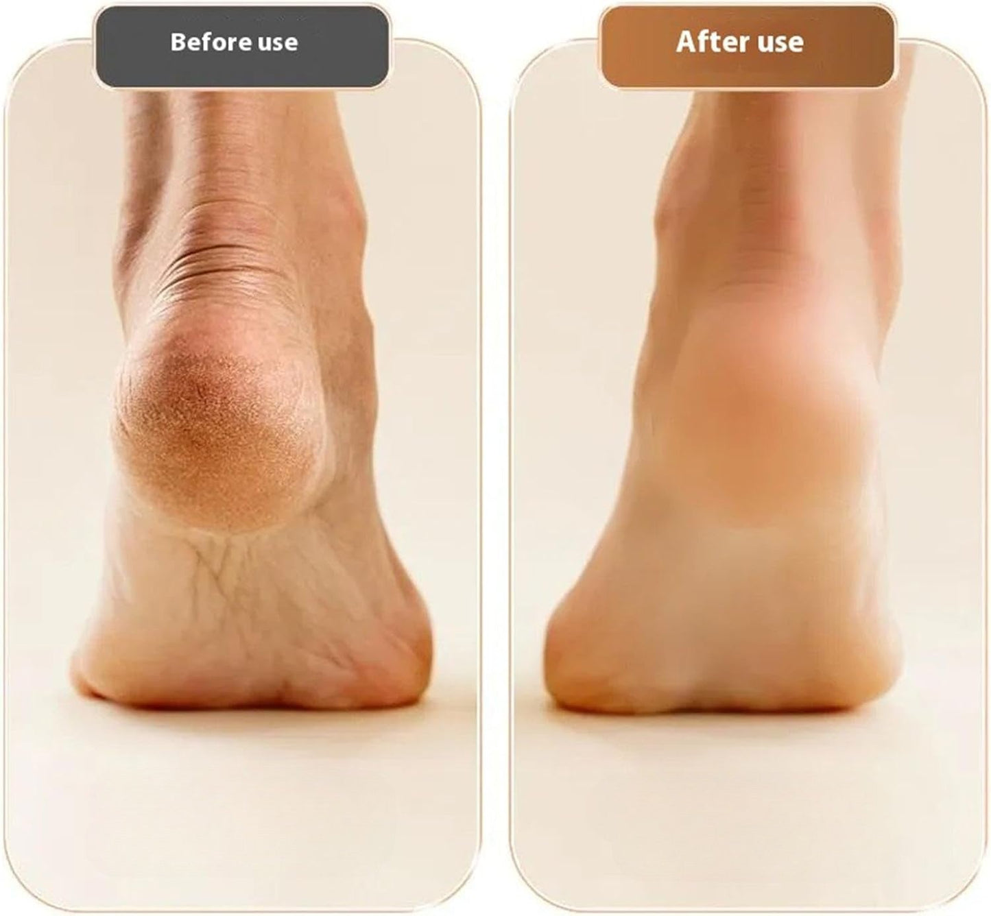Elektrische Eeltverwijderaar Ergonomisch Design Professionele Voetverzorging Pedicure Thuis Gladde Zachte Voeten