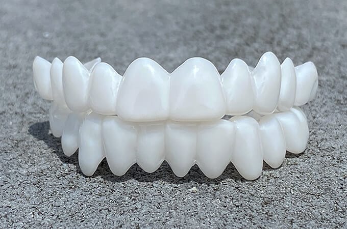 Tandprothese met Aanpasbare Lensstructuur voor Natuurlijk Uiterlijk