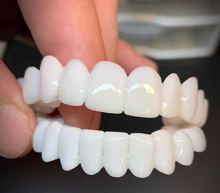Tandprothese met Aanpasbare Lensstructuur voor Natuurlijk Uiterlijk
