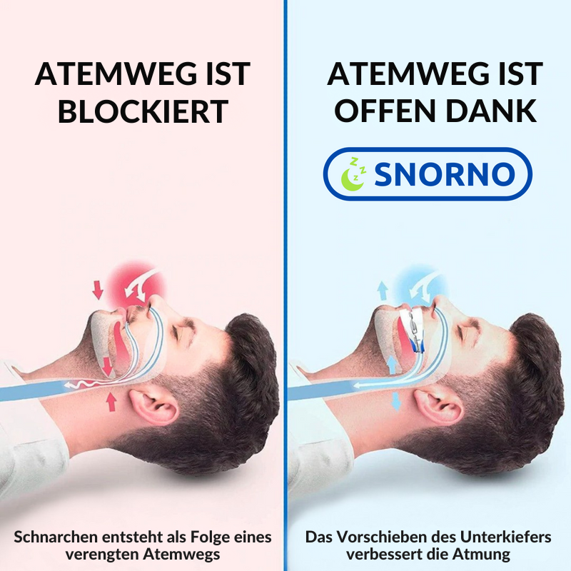 Verstelbaar Anti-Snurk Mondstuk met Ergonomische Pasvorm voor Comfortabele Nachtrust