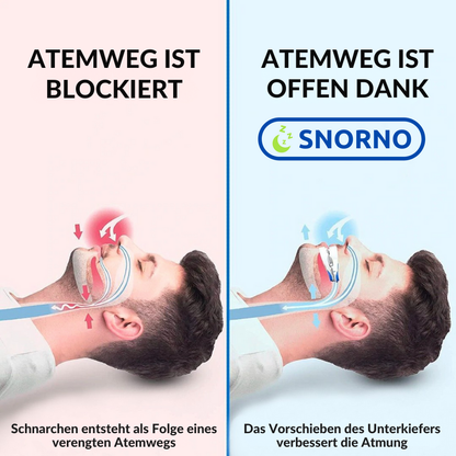 Verstelbaar Anti-Snurk Mondstuk met Ergonomische Pasvorm voor Comfortabele Nachtrust