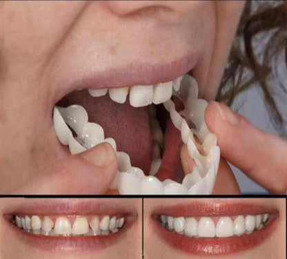 Cosmetisch Opzetgebit Flexibel Siliconen Tijdelijke Tandenset voor Natuurlijk Uiterlijk