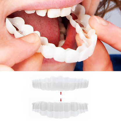 Cosmetische Snap-On Tandcovers Set – Herbruikbare Facings voor Direct Mooiere Glimlach