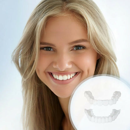 Cosmetische Snap-On Tandcovers Set – Herbruikbare Facings voor Direct Mooiere Glimlach
