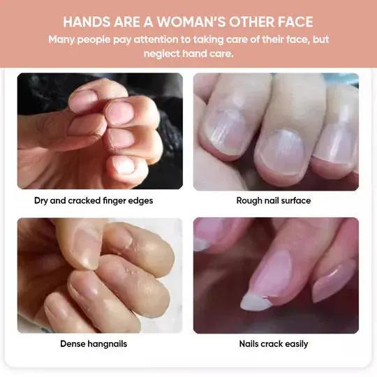 Nagelremolie voor Sterke en Glanzende Nagels 5ml