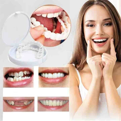 Opzetprothese SnapSmile Instelbare Tandprothese Wit Cosmetisch | Natuurlijk Lachje Zonder Tandarts Flexibele Pasvorm Herbruikbaar