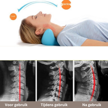 Nekmassagekussen Ergonomisch EVA Blauw 21.5x20x11cm Nekstretch Ontspanning