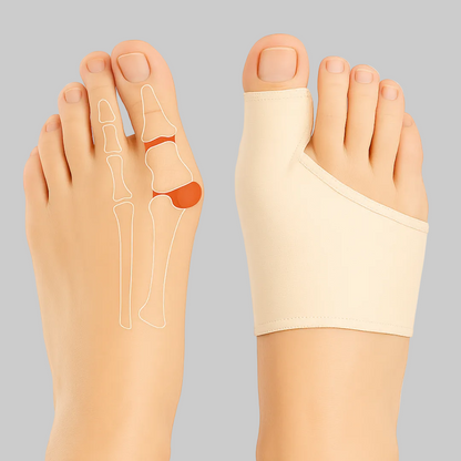 Bunion Corrector met Gelpads voor Hallux Valgus Verlichting