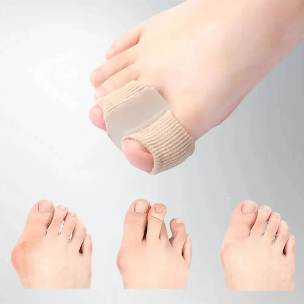 Teenspreiderset Siliconen voor Hallux Valgus en Overlappende Tenen – Zachte Correctie & Pijnverlichting