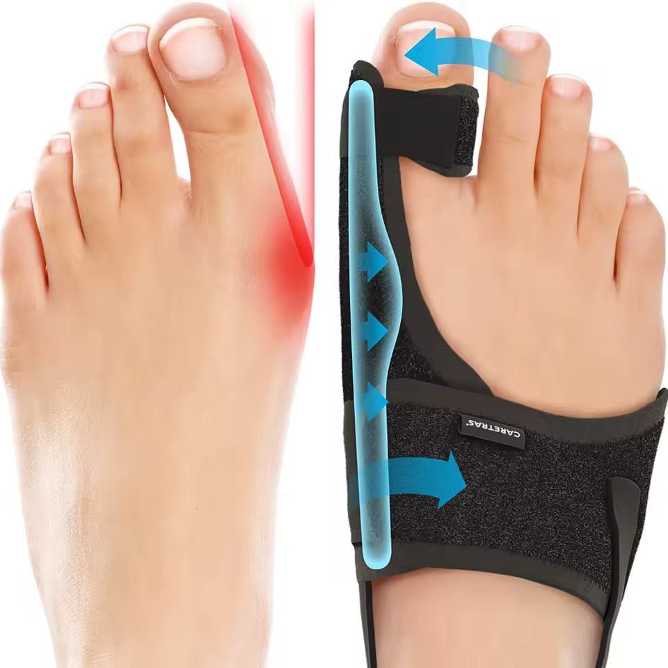 Verstelbare Teenspalk voor Nachts – Ergonomische Correctie voor Links en Rechts