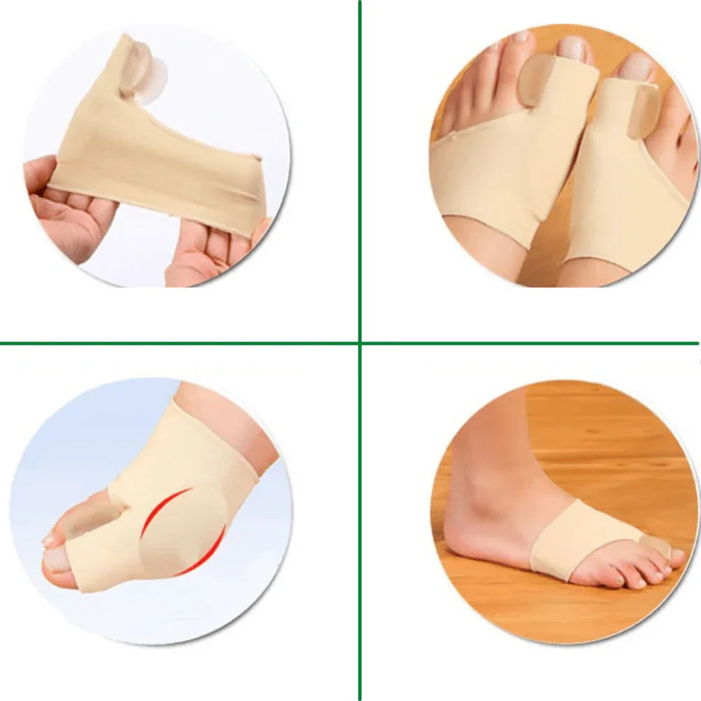 Teencorrector Hallux Valgus Gel Siliconen Voetorthese Teenstandverbetering Comfortabel Draagbaar Pijnverlichting