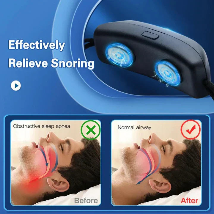 Anti-Snurk Apparaat EMS Impulstechnologie Oplaadbaar Comfortabel voor Rustige Nachtrust Ademhalingshulp Verstelbare Intensiteit Draagbaar Ontwerp